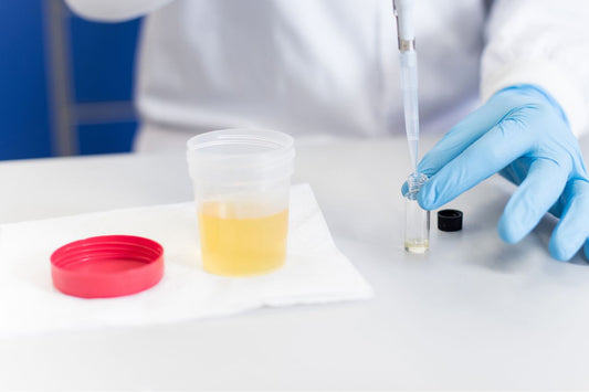 En läkare testar ett urinprov